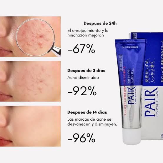 Crema para Acné Pair (14 gr)